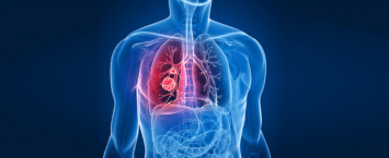 Compresión neumática intermitente de la pierna y profilaxis farmacológica para la prevención de la tromboembolia venosa en pacientes de alto riesgo