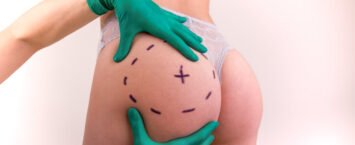 Checklist Pre-Quirúrgico Esencial: No Arriesgues tu Cirugía por Hipertensión