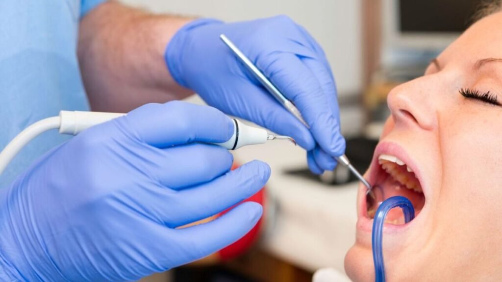 Placa bacteriana y sarro dental: Diferencias clínicas clave y prevención