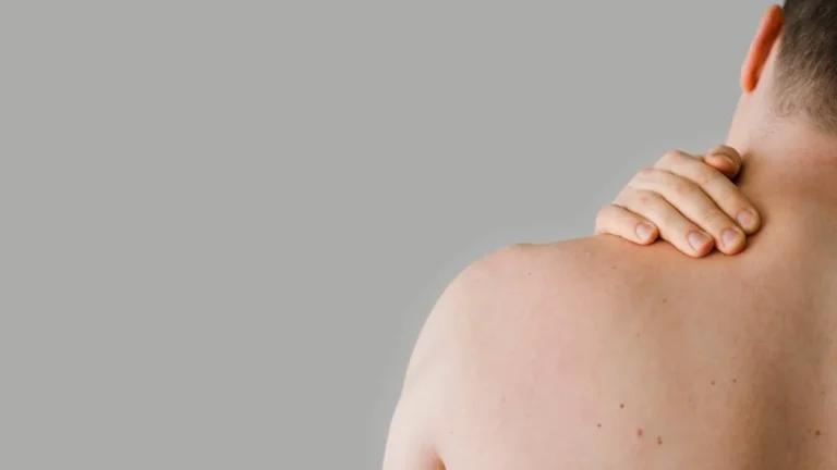 Cambios en los Lunares: Cuándo Consultar al Dermatólogo según la Regla ABCDE