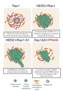 Metástasis en Cáncer de Mama: La Modificación de RAC1 como Diana Terapéutica