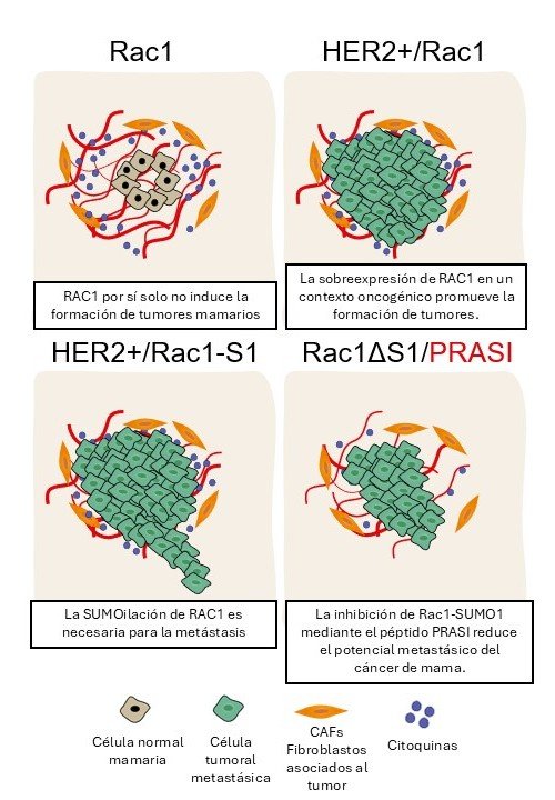 Metástasis en Cáncer de Mama: La Modificación de RAC1 como Diana Terapéutica