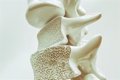 Salud Ósea y Envejecimiento Cerebral: Lo que Tus Huesos Revelan Sobre tu Mente