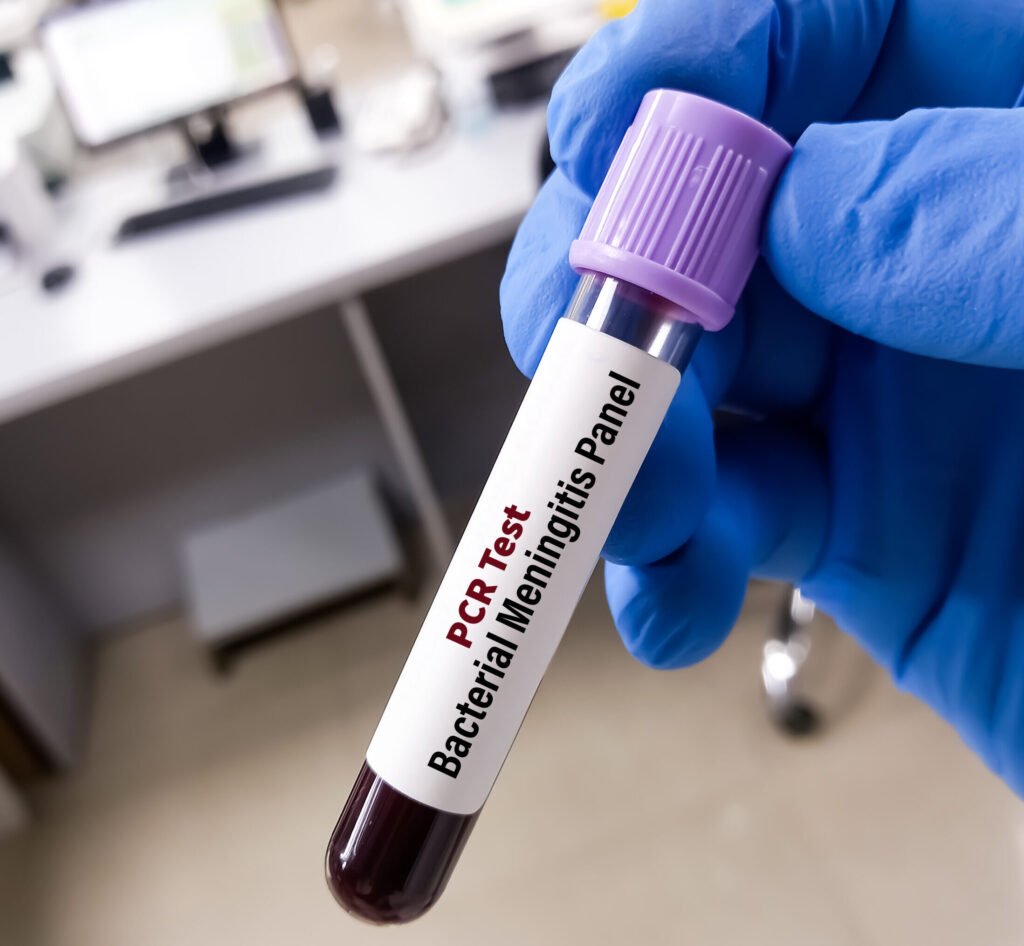 España Liderará Laboratorio Europeo de Enfermedad Invasiva: Avances y Desafíos Clínicos del Neumococo