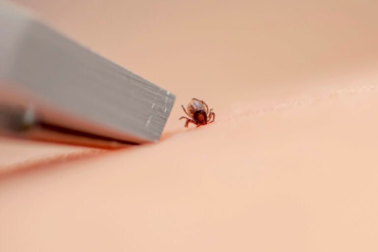 Nuevo Virus Transmitido por Garrapatas (ALTNV): Implicaciones Clínicas y Retos Diagnósticos