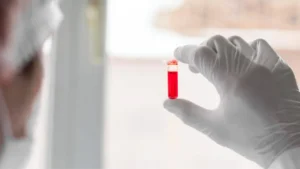 Tumores Sanguíneos y Oncohematología: Radiografía Clínica y Perspectivas de Diagnóstico