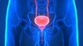 Mitos y Realidades sobre la Prevención del Cáncer de Próstata: ¿Existe un Alimento Milagroso?