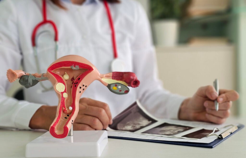 Abordaje Clínico y Realidades de los Tumores Ginecológicos: Enfoque Integral en Salud de la Mujer