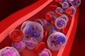 Proyecciones y Abordaje Clínico del Cáncer Hematológico: Retos en la Oncología Moderna