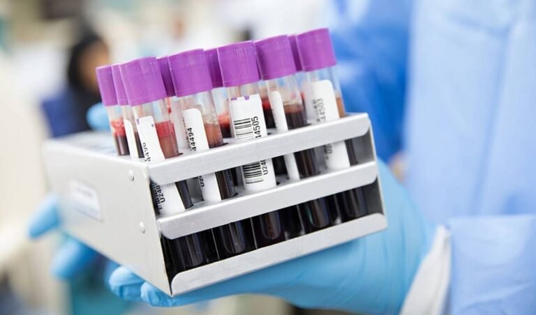 Predicción Temprana del Alzheimer: Nuevos Avances en Análisis de Sangre y Test Genéticos
