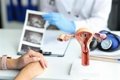 ¿El mioma uterino puede convertirse en cáncer? Verdades y mitos sobre los tumores benignos