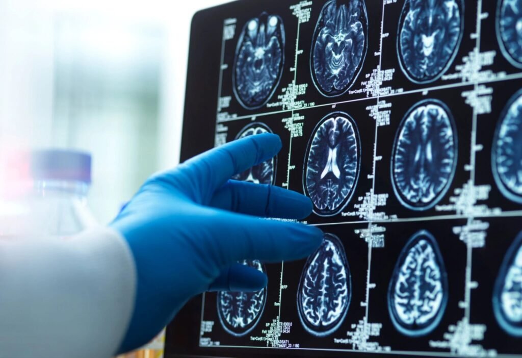 Impacto Clínico y Desafíos en el Acceso a Nuevos Fármacos para el Alzheimer