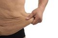 El Reto del Exceso de Piel Tras Perder Muchos Kilos: Causas, Abordaje y Salud Integral