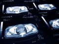 Cáncer de Próstata y Nutrición: Sustituir Grasas Animales por Aceite de Oliva Reduce la Mortalidad