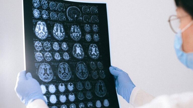 Inteligencia Artificial en el Diagnóstico y Tratamiento de Tumores Cerebrales