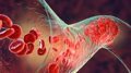 Nivel óptimo de hemoglobina y su asociación con una menor mortalidad según nuevo estudio clínico