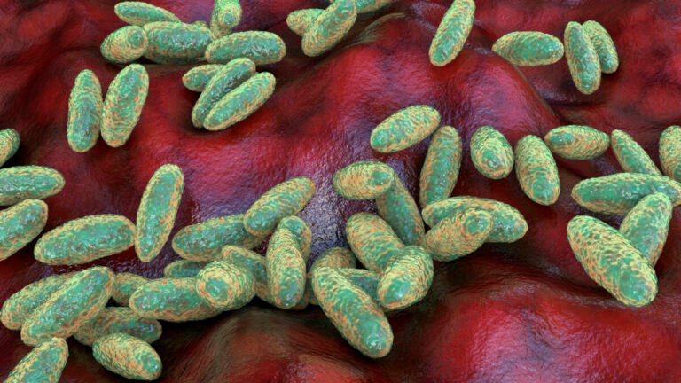 Peste Neumónica en Rusia: Rigor Científico, Vigilancia Sanitaria y Análisis Clínico