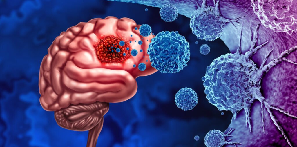 Nueva Generación de Radioterapia para Tumores Cerebrales: Avances del Proyecto InnovaRTBRAIN