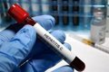 Hepatitis C y Trastorno Mental Grave: Una Perspectiva Clínica Integral