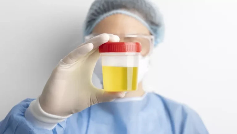 Nuevas Pistas Diagnósticas en Cáncer de Vejiga: El Poder de la Orina